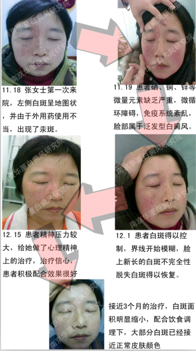 张女士.png